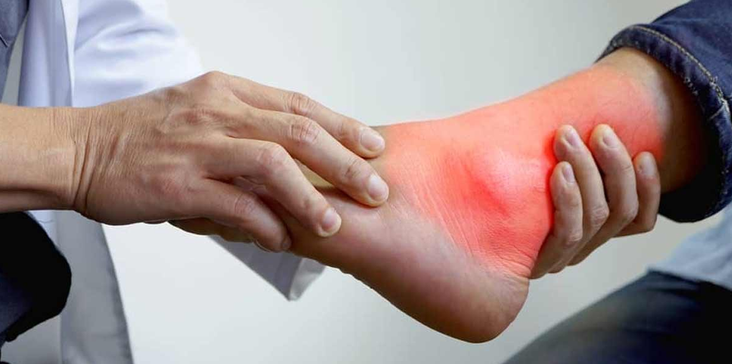 5 Obat Asam Urat Alami Rekomendasi Kemenkes